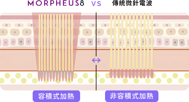 3D立體容積式加熱能量釋放示意圖